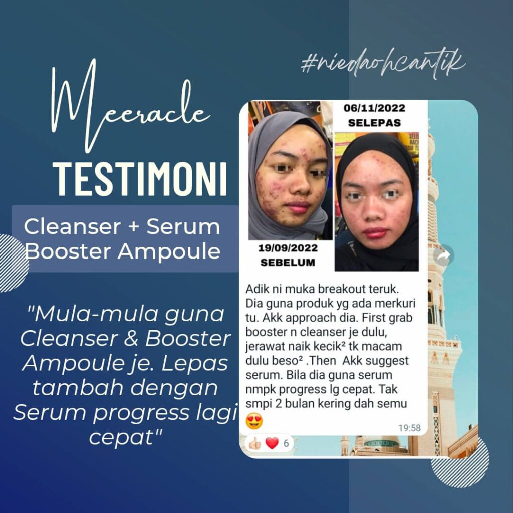 Air Infused Lemon – Kesan Sebenar Pada Kulit