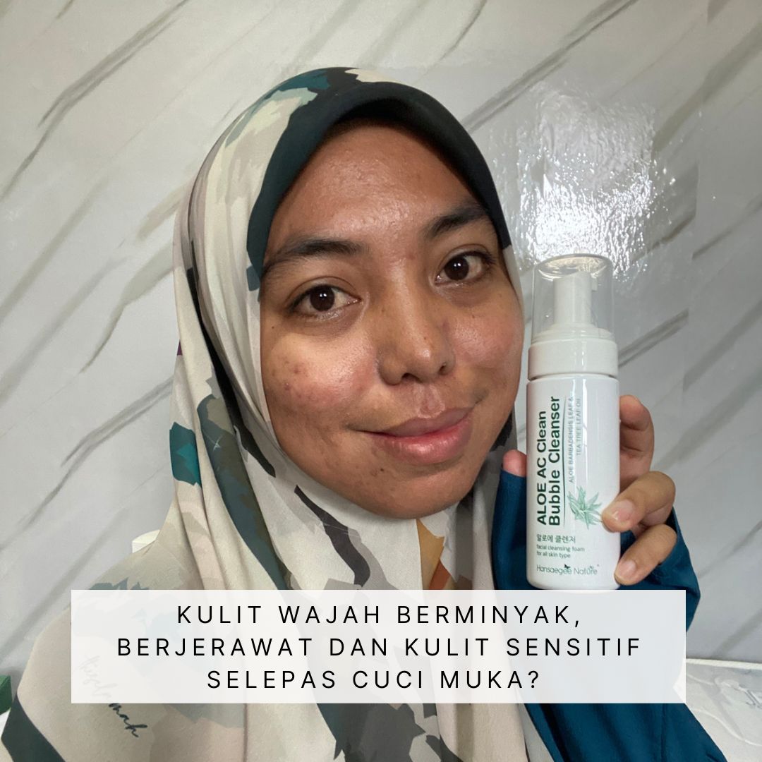 Ulasan Pencuci Muka Alia Skincare – Sesuai Untuk Kulit Jerawat?